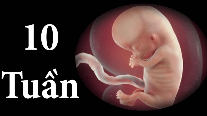 Hình Ảnh Thai Nhi 10 Tuần Trong Bụng Mẹ: Đánh Giá Sự Phát Triển, Dấu Hiệu Khỏe Mạnh & Cách Kiểm Tra Đúng Cách Cho Mẹ Bầu