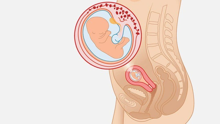 Hình Ảnh Thai Nhi 10 Tuần Trong Bụng Mẹ: Đánh Giá Sự Phát Triển, Dấu Hiệu Khỏe Mạnh & Cách Kiểm Tra Đúng Cách Cho Mẹ Bầu