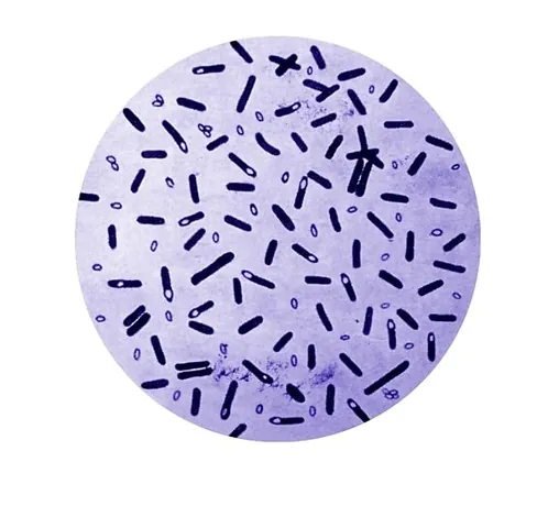 Xem Hình Ảnh Trực Khuẩn Và Phân Biệt Các Dạng Hình Thể Vi Khuẩn Cho Người Học Y Xem Hình Ảnh Trực Khuẩn Và Phân Biệt Các Dạng Hình Thể Vi Khuẩn Cho Người Học Y