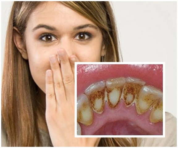 Hình Ảnh Trước & Sau Khi Lấy Cao Răng: Kết Quả Thực Tế, Quy Trình & Lưu Ý Cho Người Đọc