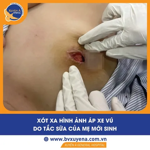 Xem Hình Ảnh Tuyến Sữa Thực Tế: Cấu Tạo, Vị Trí Và Chức Năng Ở Phụ Nữ Xem Hình Ảnh Tuyến Sữa Thực Tế: Cấu Tạo, Vị Trí Và Chức Năng Ở Phụ Nữ