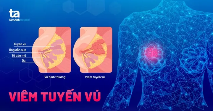 Xem Hình Ảnh Tuyến Sữa Thực Tế: Cấu Tạo, Vị Trí Và Chức Năng Ở Phụ Nữ Xem Hình Ảnh Tuyến Sữa Thực Tế: Cấu Tạo, Vị Trí Và Chức Năng Ở Phụ Nữ