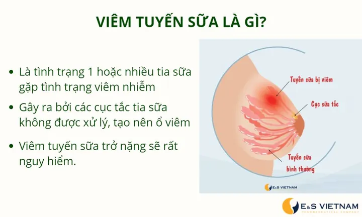 Xem Hình Ảnh Tuyến Sữa Thực Tế: Cấu Tạo, Vị Trí Và Chức Năng Ở Phụ Nữ Xem Hình Ảnh Tuyến Sữa Thực Tế: Cấu Tạo, Vị Trí Và Chức Năng Ở Phụ Nữ