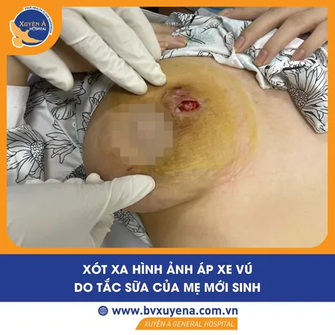 Xem Hình Ảnh Tuyến Sữa Thực Tế: Cấu Tạo, Vị Trí Và Chức Năng Ở Phụ Nữ Xem Hình Ảnh Tuyến Sữa Thực Tế: Cấu Tạo, Vị Trí Và Chức Năng Ở Phụ Nữ