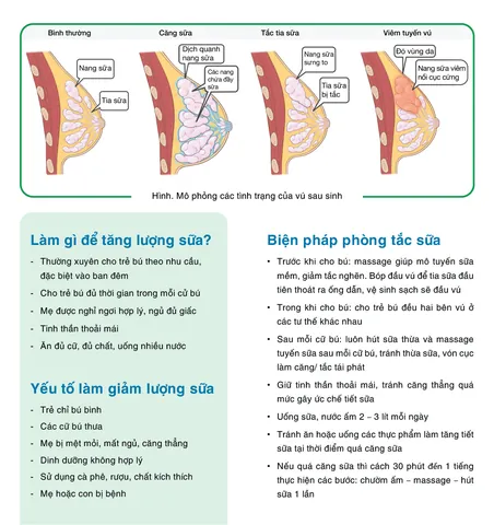 Xem Hình Ảnh Tuyến Sữa Thực Tế: Cấu Tạo, Vị Trí Và Chức Năng Ở Phụ Nữ Xem Hình Ảnh Tuyến Sữa Thực Tế: Cấu Tạo, Vị Trí Và Chức Năng Ở Phụ Nữ