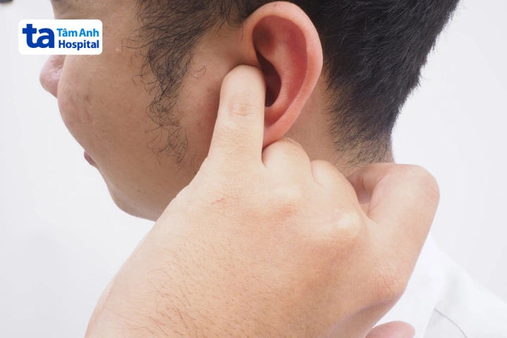 Hình Ảnh U Dây Thần Kinh Số 8: Đánh Giá Triệu Trưng, Nguyên Nhân, Chẩn Đoán & Phương Pháp Điều Trị Dành Cho Bệnh Nhân