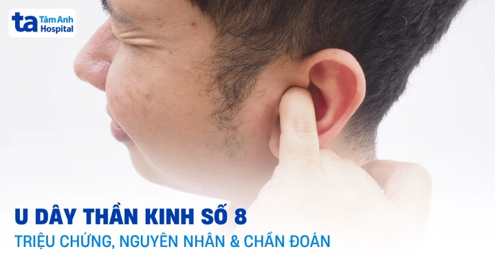 Hình Ảnh U Dây Thần Kinh Số 8: Đánh Giá Triệu Trưng, Nguyên Nhân, Chẩn Đoán & Phương Pháp Điều Trị Dành Cho Bệnh Nhân