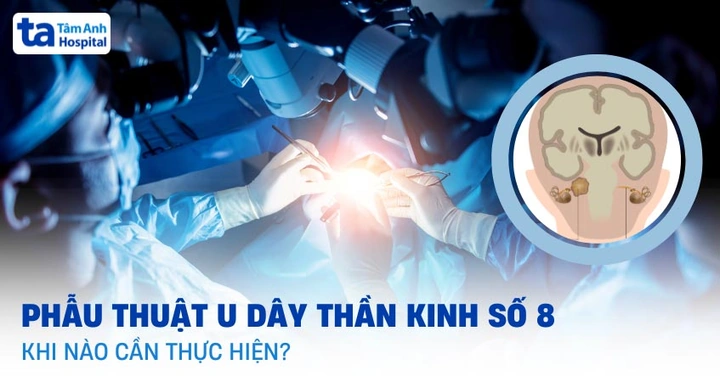 Hình Ảnh U Dây Thần Kinh Số 8: Đánh Giá Triệu Trưng, Nguyên Nhân, Chẩn Đoán & Phương Pháp Điều Trị Dành Cho Bệnh Nhân