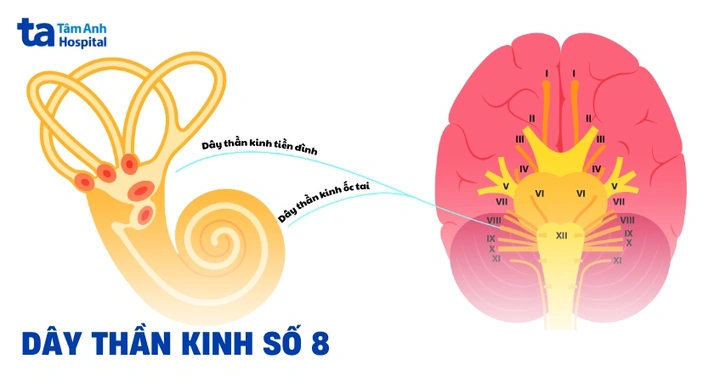 Hình Ảnh U Dây Thần Kinh Số 8: Đánh Giá Triệu Trưng, Nguyên Nhân, Chẩn Đoán & Phương Pháp Điều Trị Dành Cho Bệnh Nhân