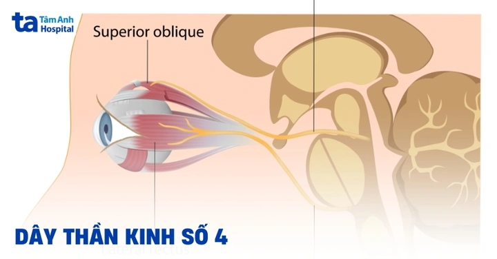 Hình Ảnh U Dây Thần Kinh Số 8: Đánh Giá Triệu Trưng, Nguyên Nhân, Chẩn Đoán & Phương Pháp Điều Trị Dành Cho Bệnh Nhân
