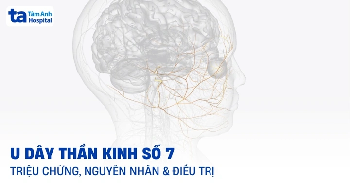 Hình Ảnh U Dây Thần Kinh Số 8: Đánh Giá Triệu Trưng, Nguyên Nhân, Chẩn Đoán & Phương Pháp Điều Trị Dành Cho Bệnh Nhân