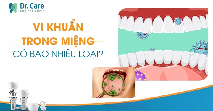 Hình Ảnh Vi Khuẩn Trong Khoang Miệng: Đánh Giá Chi Tiết, Loại Vi Khuẩn Và Ảnh Hưởng Tới Sức Khỏe (dành Cho Người Tìm Hiểu Y Khoa & Bệnh Nhân) Hình Ảnh Vi Khuẩn Trong Khoang Miệng: Đánh Giá Chi Tiết, Loại Vi Khuẩn Và Ảnh Hưởng Tới Sức Khỏe (dành Cho Người Tìm Hiểu Y Khoa & Bệnh Nhân)