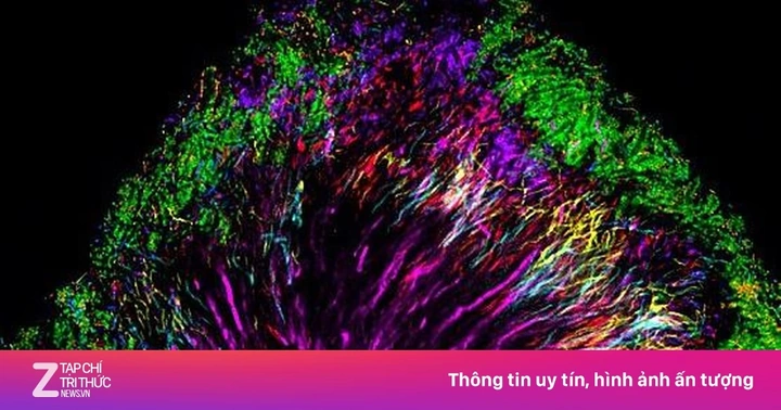 Hình Ảnh Vi Khuẩn Trong Khoang Miệng: Đánh Giá Chi Tiết, Loại Vi Khuẩn Và Ảnh Hưởng Tới Sức Khỏe (dành Cho Người Tìm Hiểu Y Khoa & Bệnh Nhân) Hình Ảnh Vi Khuẩn Trong Khoang Miệng: Đánh Giá Chi Tiết, Loại Vi Khuẩn Và Ảnh Hưởng Tới Sức Khỏe (dành Cho Người Tìm Hiểu Y Khoa & Bệnh Nhân)