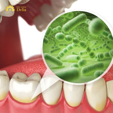 Hình Ảnh Vi Khuẩn Trong Khoang Miệng: Đánh Giá Chi Tiết, Loại Vi Khuẩn Và Ảnh Hưởng Tới Sức Khỏe (dành Cho Người Tìm Hiểu Y Khoa & Bệnh Nhân) Hình Ảnh Vi Khuẩn Trong Khoang Miệng: Đánh Giá Chi Tiết, Loại Vi Khuẩn Và Ảnh Hưởng Tới Sức Khỏe (dành Cho Người Tìm Hiểu Y Khoa & Bệnh Nhân)