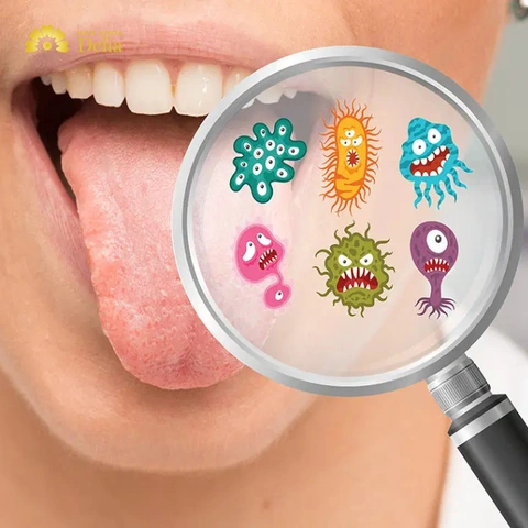 Hình Ảnh Vi Khuẩn Trong Khoang Miệng: Đánh Giá Chi Tiết, Loại Vi Khuẩn Và Ảnh Hưởng Tới Sức Khỏe (dành Cho Người Tìm Hiểu Y Khoa & Bệnh Nhân) Hình Ảnh Vi Khuẩn Trong Khoang Miệng: Đánh Giá Chi Tiết, Loại Vi Khuẩn Và Ảnh Hưởng Tới Sức Khỏe (dành Cho Người Tìm Hiểu Y Khoa & Bệnh Nhân)