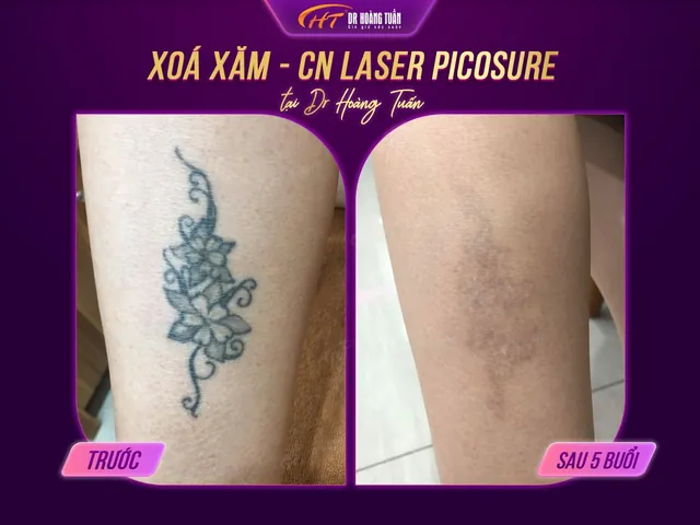 Tổng Hợp Hình Ảnh Xàm (meme, Avatar Xàm) Giải Trí Cho Dân Mạng Tổng Hợp Hình Ảnh Xàm (meme, Avatar Xàm) Giải Trí Cho Dân Mạng