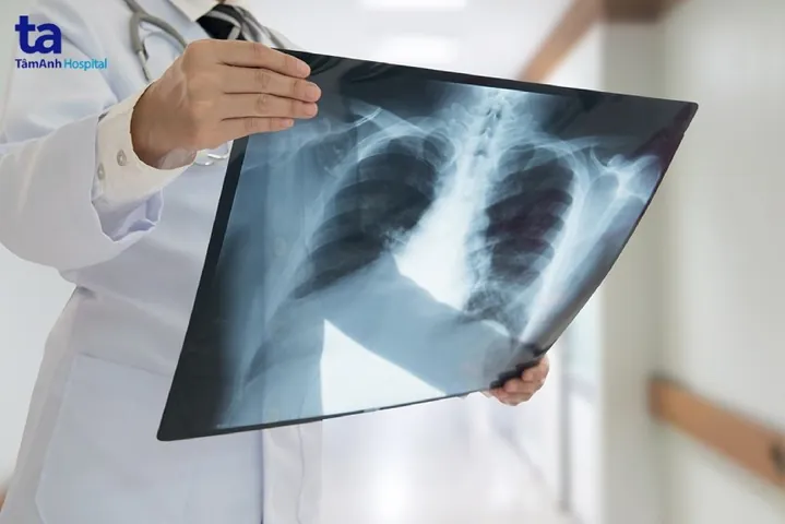 Nhận Diện Hình Ảnh Xquang Phổi Bình Thường Và Bất Thường Cho Người Đọc Phổ Thông Nhận Diện Hình Ảnh Xquang Phổi Bình Thường Và Bất Thường Cho Người Đọc Phổ Thông