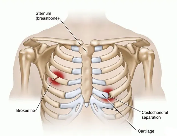 Xem Hình Ảnh Xương Sườn Người: Cấu Tạo Lồng Ngực Và Các Loại Xương Sườn Thật Giả Xem Hình Ảnh Xương Sườn Người: Cấu Tạo Lồng Ngực Và Các Loại Xương Sườn Thật Giả