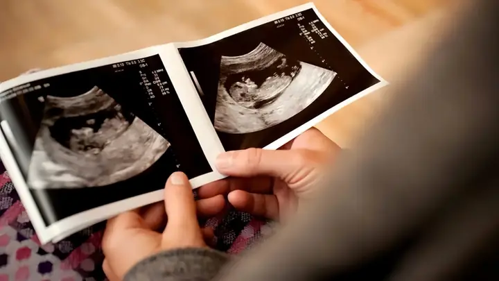 Cách Lắc Nhẫn Để Biết Trai Hay Gái Cho Mẹ Bầu Theo Dân Gian Cách Lắc Nhẫn Để Biết Trai Hay Gái Cho Mẹ Bầu Theo Dân Gian