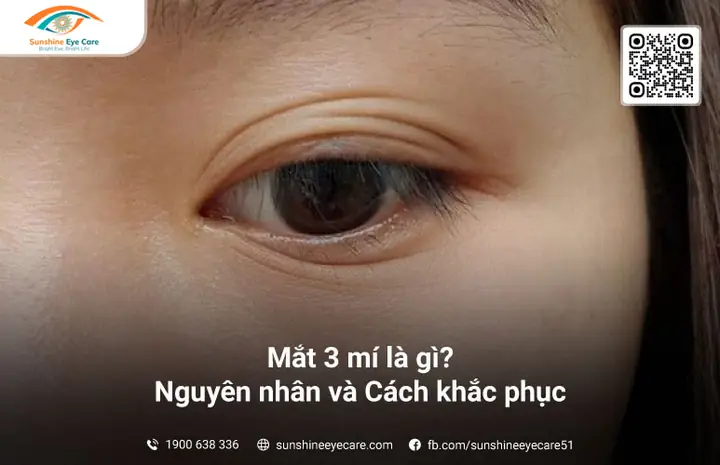 Giải Nghĩa Mắt 3 Mí Trong Nhân Tướng Học Và Vận Mệnh Cuộc Đời Giải Nghĩa Mắt 3 Mí Trong Nhân Tướng Học Và Vận Mệnh Cuộc Đời