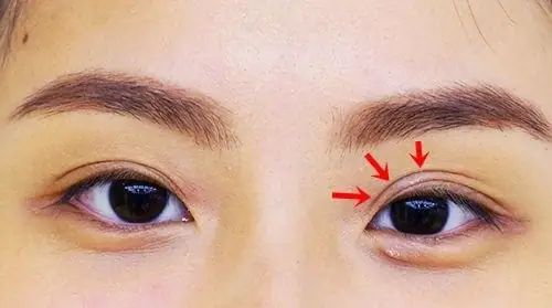Mắt Lệch Mí Tướng Số: Nguyên Nhân Và Cách Khắc Phục Hiệu Quả Mắt Lệch Mí Tướng Số: Nguyên Nhân Và Cách Khắc Phục Hiệu Quả