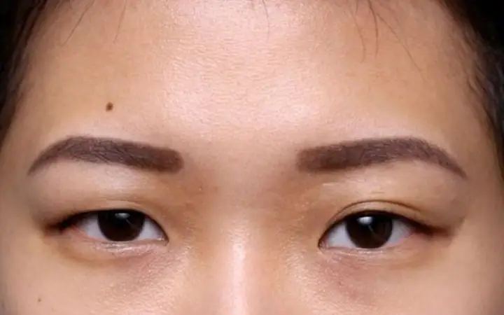 Mắt Lệch Mí Tướng Số: Nguyên Nhân Và Cách Khắc Phục Hiệu Quả Mắt Lệch Mí Tướng Số: Nguyên Nhân Và Cách Khắc Phục Hiệu Quả