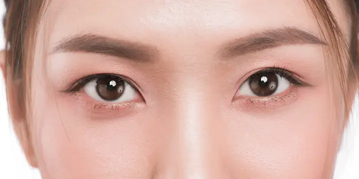 Mắt Mí Lót Là Gì? Giải Mã Tướng Số, Ý Nghĩa Vận Mệnh Nam Nữ & Cách Khắc Phục Hiệu Quả