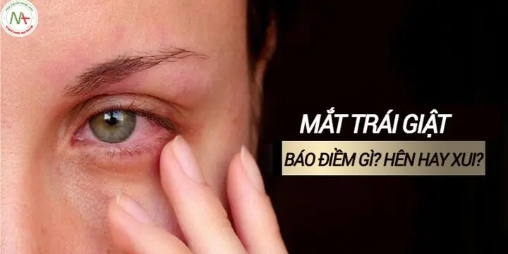 Giải Mã Mắt Trái Giật Có Điềm Báo Gì Theo Giờ Và Giới Tính Nam, Nữ Giải Mã Mắt Trái Giật Có Điềm Báo Gì Theo Giờ Và Giới Tính Nam, Nữ