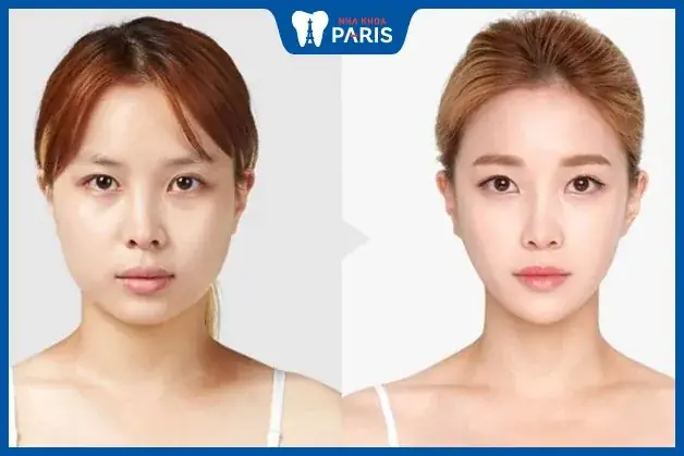 Giải Mã Tướng Số Mặt Tròn: Ý Nghĩa, Tính Cách, Vận Mệnh Nam Nữ & Kiểu Tóc Phù Hợp