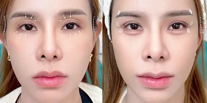 Tổng Hợp Các Loại Mắt Trong Nhân Tướng Học: Giải Mã Ý Nghĩa Vận Mệnh, Tính Cách Và Tướng Số Nam Nữ Chi Tiết Tổng Hợp Các Loại Mắt Trong Nhân Tướng Học: Giải Mã Ý Nghĩa Vận Mệnh, Tính Cách Và Tướng Số Nam Nữ Chi Tiết