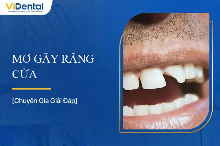 Giải Mã Giấc Mơ Gãy Răng Cửa: Điềm Báo, Ý Nghĩa Theo Trạng Thái Và Con Số May Mắn Giải Mã Giấc Mơ Gãy Răng Cửa: Điềm Báo, Ý Nghĩa Theo Trạng Thái Và Con Số May Mắn