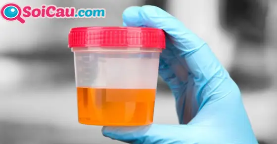 Giải Mã Giấc Mơ Thấy Nước Tiểu: Đánh Số Mấy Và Ý Nghĩa Điềm Báo Giải Mã Giấc Mơ Thấy Nước Tiểu: Đánh Số Mấy Và Ý Nghĩa Điềm Báo