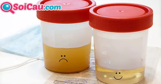 Giải Mã Giấc Mơ Thấy Nước Tiểu: Đánh Số Mấy Và Ý Nghĩa Điềm Báo Giải Mã Giấc Mơ Thấy Nước Tiểu: Đánh Số Mấy Và Ý Nghĩa Điềm Báo