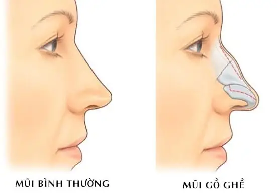 Giải Mã Tướng Số Mũi Cao: Ý Nghĩa Vận Mệnh, Tính Cách Nam Nữ & Phân Loại Dáng Mũi Quý Giải Mã Tướng Số Mũi Cao: Ý Nghĩa Vận Mệnh, Tính Cách Nam Nữ & Phân Loại Dáng Mũi Quý