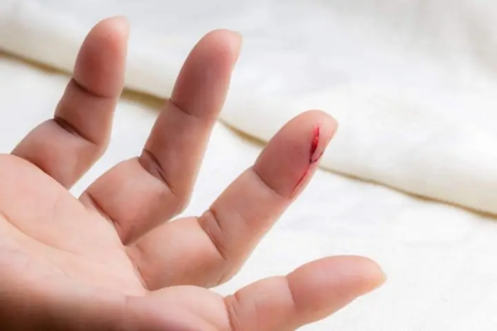 Giải Mã Giấc Mơ Thấy Bàn Tay Bị Chặt: Ý Nghĩa, Nguyên Nhân Và Cách Giải Thích Chi Tiết Giải Mã Giấc Mơ Thấy Bàn Tay Bị Chặt: Ý Nghĩa, Nguyên Nhân Và Cách Giải Thích Chi Tiết