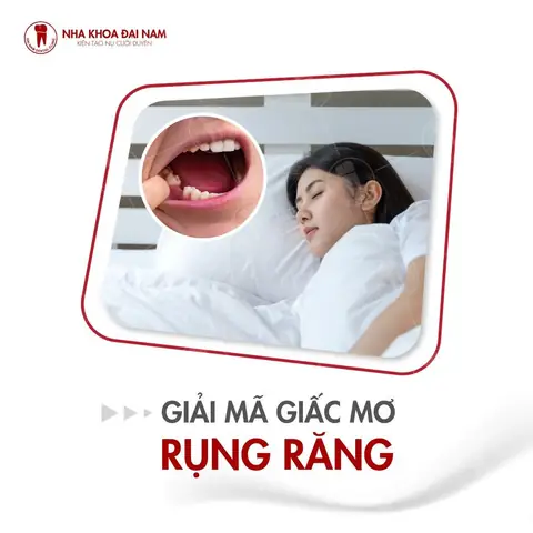 Giải Mã Ý Nghĩa Nằm Mơ Thấy Bị Đau Răng: Điềm Báo Tốt Xấu Và Nguyên Nhân