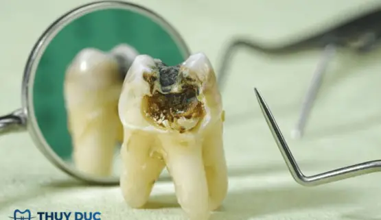 Giải Mã Ý Nghĩa Nằm Mơ Thấy Bị Đau Răng: Điềm Báo Tốt Xấu Và Nguyên Nhân