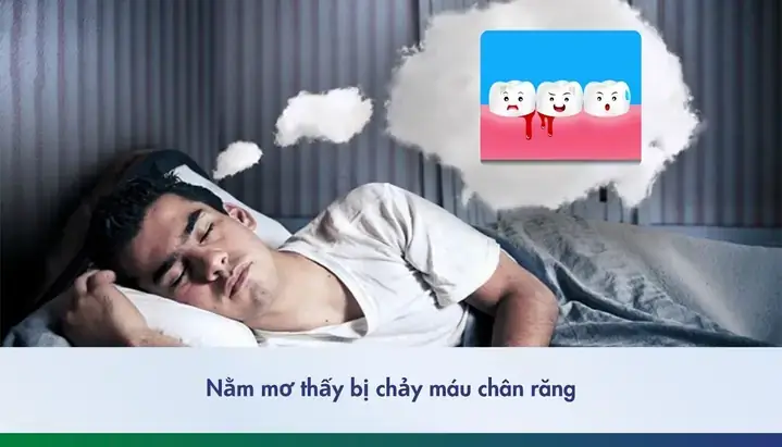 Nằm Mơ Thấy Đứt Chân Chảy Máu: Ý Nghĩa, Điềm Báo Và Cách Giải Thích Chi Tiết