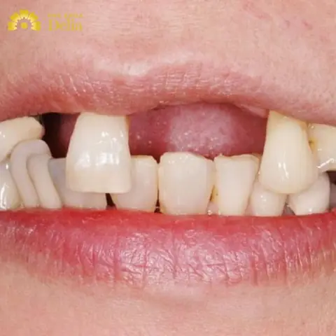 Giải Mã Giấc Mơ Thấy Hàm Răng Đẹp: Ý Nghĩa Và Điềm Báo Trong Đời Sống Giải Mã Giấc Mơ Thấy Hàm Răng Đẹp: Ý Nghĩa Và Điềm Báo Trong Đời Sống
