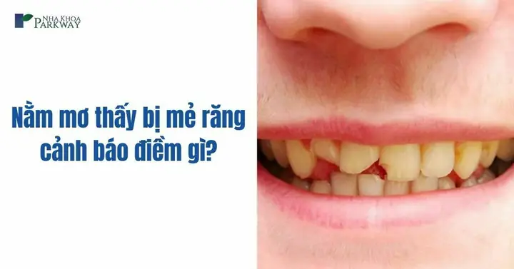 Giải Mã Ý Nghĩa Nằm Mơ Thấy Mẻ Răng Cửa: Điềm Báo Và Góc Nhìn Tâm Lý