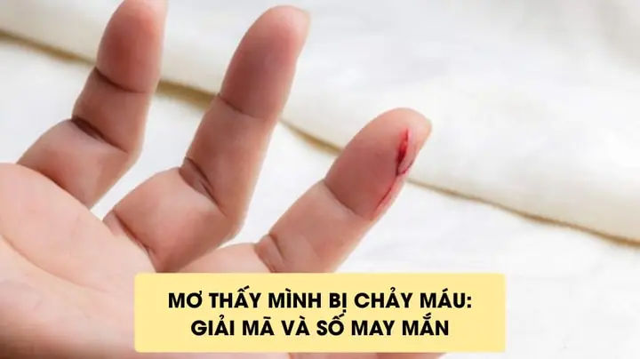 Giải Mã Nằm Mơ Thấy Mình Chảy Máu: Ý Nghĩa Điềm Báo Và Con Số Đánh Lô Đề