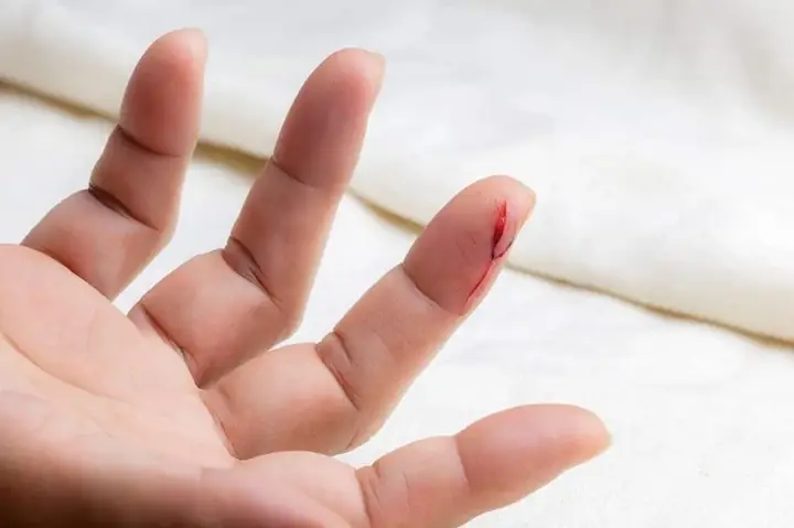 Giải Mã Nằm Mơ Thấy Mình Chảy Máu: Ý Nghĩa Điềm Báo Và Con Số Đánh Lô Đề