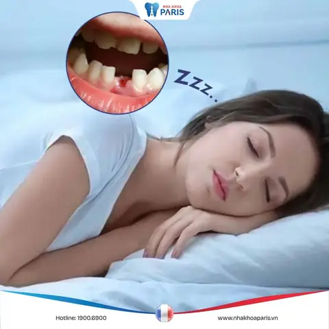 Giải Mã Ý Nghĩa Nằm Mơ Thấy Rụng Nhiều Răng: Điềm Báo Và Con Số Liên Quan