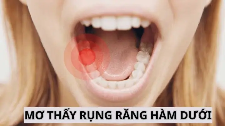 Nằm Mơ Thấy Rụng Răng Hàm Dưới: Ý Nghĩa, Dự Báo Và Cách Giải Thích Chi Tiết Nằm Mơ Thấy Rụng Răng Hàm Dưới: Ý Nghĩa, Dự Báo Và Cách Giải Thích Chi Tiết