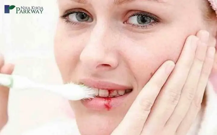 Nằm Mơ Thấy Rụng Răng Hàm Dưới: Ý Nghĩa, Dự Báo Và Cách Giải Thích Chi Tiết Nằm Mơ Thấy Rụng Răng Hàm Dưới: Ý Nghĩa, Dự Báo Và Cách Giải Thích Chi Tiết
