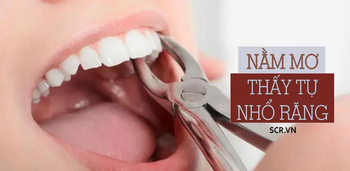 Giải Mã Ý Nghĩa Nằm Mơ Thấy Tự Nhổ Răng Mình: Điểm Báo Tốt Hay Xấu? Giải Mã Ý Nghĩa Nằm Mơ Thấy Tự Nhổ Răng Mình: Điểm Báo Tốt Hay Xấu?