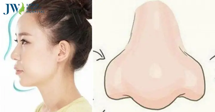 Giải Mã Tướng Mũi Cà Chua Ở Nam Giới Theo Nhân Tướng Học Và Thẩm Mỹ Giải Mã Tướng Mũi Cà Chua Ở Nam Giới Theo Nhân Tướng Học Và Thẩm Mỹ