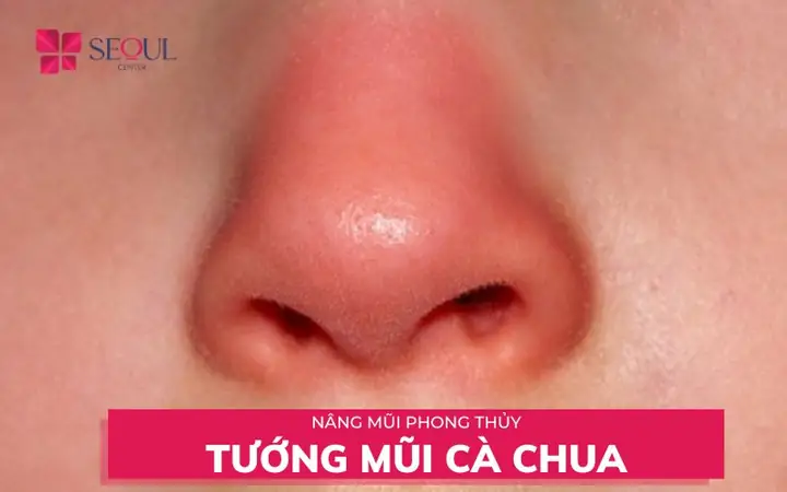 Giải Mã Tướng Mũi Cà Chua Ở Nam Giới Theo Nhân Tướng Học Và Thẩm Mỹ Giải Mã Tướng Mũi Cà Chua Ở Nam Giới Theo Nhân Tướng Học Và Thẩm Mỹ