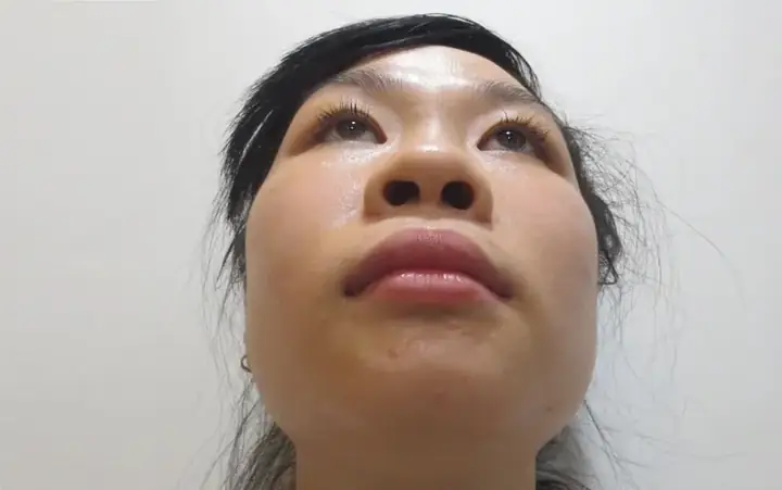 Giải Mã Tướng Mũi Cà Chua Ở Nam Giới Theo Nhân Tướng Học Và Thẩm Mỹ Giải Mã Tướng Mũi Cà Chua Ở Nam Giới Theo Nhân Tướng Học Và Thẩm Mỹ