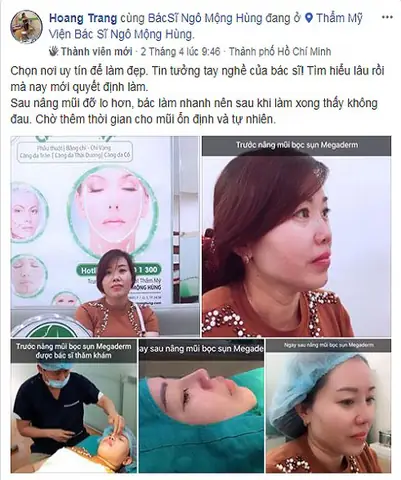 Nâng Mũi Có Thay Đổi Tướng Số Không: Góc Nhìn Nhân Tướng Học Và Khoa Học Nâng Mũi Có Thay Đổi Tướng Số Không: Góc Nhìn Nhân Tướng Học Và Khoa Học